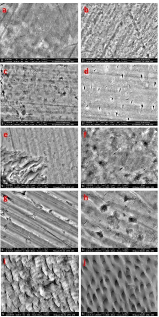 Figure 1. Scanning Electron Microscopy of enamel and human dentin submitted to different methods of sterilization and control group
