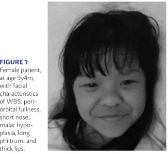 FIGURE 1:  Female patient,  at age 9y4m,  with facial  characteristics  of WBS:  peri-orbital fullness,  short nose,  malar  hypo-plasia, long  philtrum, and  thick lips.