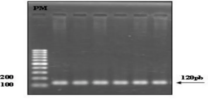 Figura 6 –  Perfil eletroforético do fragmento de 120pb amplificado do éxon 1 do gene  globina (PM - Peso Molecular de 100pb)
