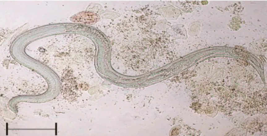 Figura  2: Fêmea parasita de Strongyloides stercoralis. Escala=400µm  Fonte: FABRIZIO et al., 2009 