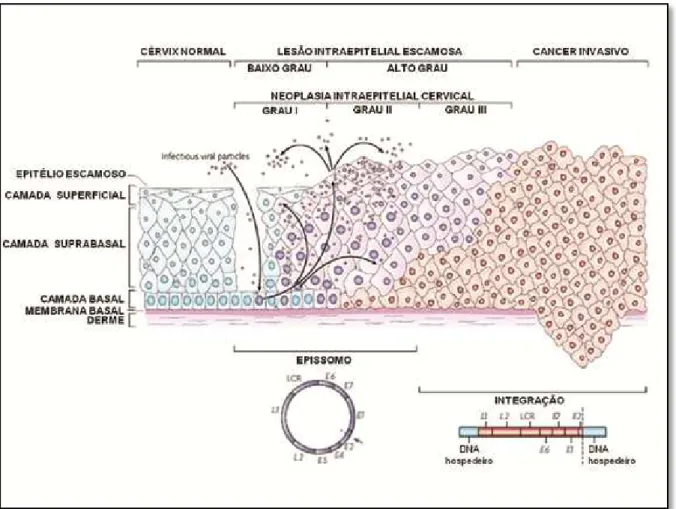Figura 9  -  Evolução e progressão da lesão até a geração de câncer 