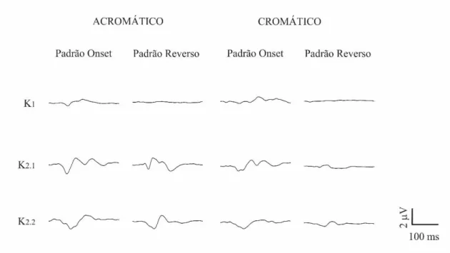 Figura 4. Forma de onda média do VECP de indivíduos com fenótipo deutan para  estímulos  acromáticos  e  compostos  apresentados  nos  padrões  onset  e  reverso