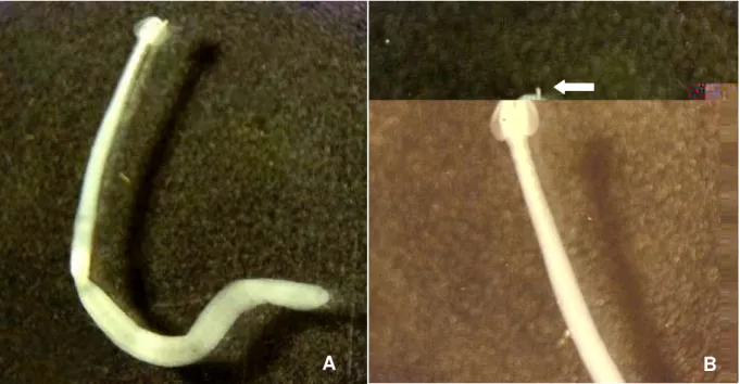 Figura 5. Larva plerocercóide de Callitetrarhynchus gracilis (A) e detalhe de sua extremidade anterior (B)  mostrando um tentáculo parcialmente exteriorizado (seta)