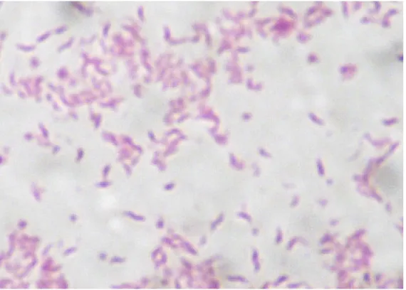 Figura 1 – Bastonetes delgados Gram-negativos com formas típicas de Campylobacter  spp