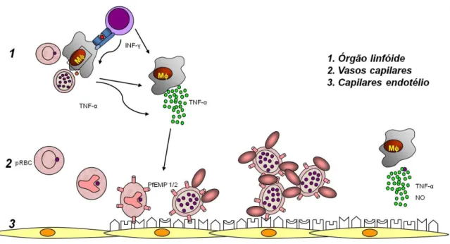 Figura 4B: Hipótese para o mecanismo da patogênese da malária cerebral. (1) Monócitos- Monócitos-macrófagos estimulados por antígenos do parasito (expressos na superfície da hemácia) e  por  citocinas  (liberadas  por  linfócitos  em  resposta  a  infecção