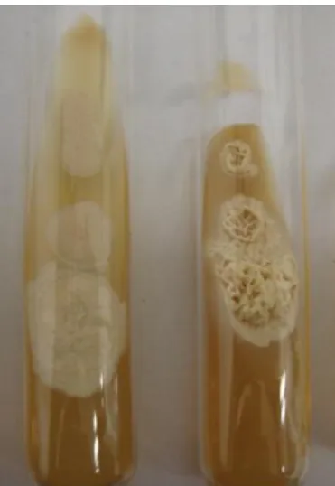 Figura 05- Culturas isolaladas de raspado ungueal. Crescimento de leveduras em meio de  cultura agar sabouraud com cloranfenicol
