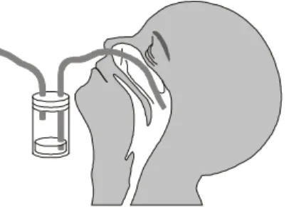 FIGURA 5. Desenho ilustrativo da coleta de aspirado da nasofaringe. 
