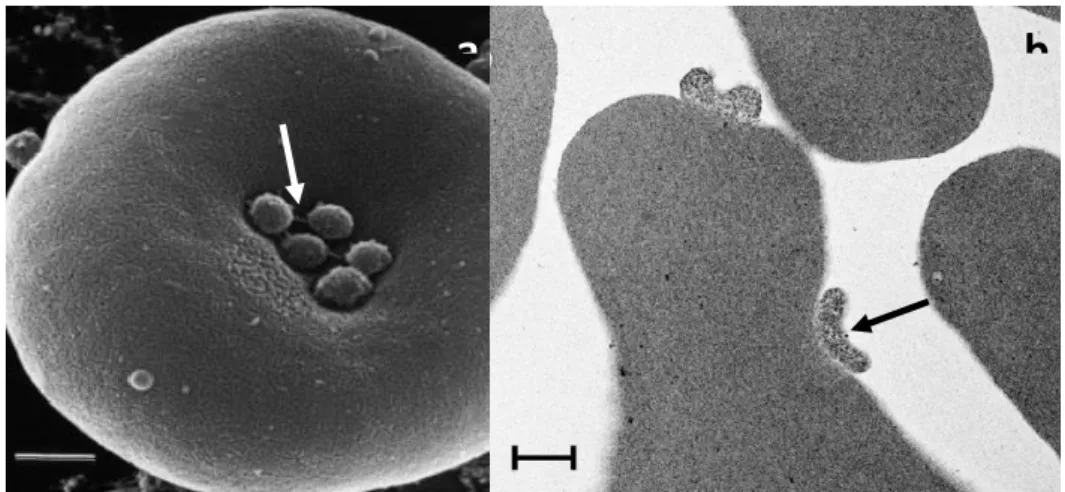 Figura 2 - (a) Microscopia eletrônica de varredura evidenciando a presença de uma cadeia de  hemoplasmas na superfície de um eritrócito de carneiro