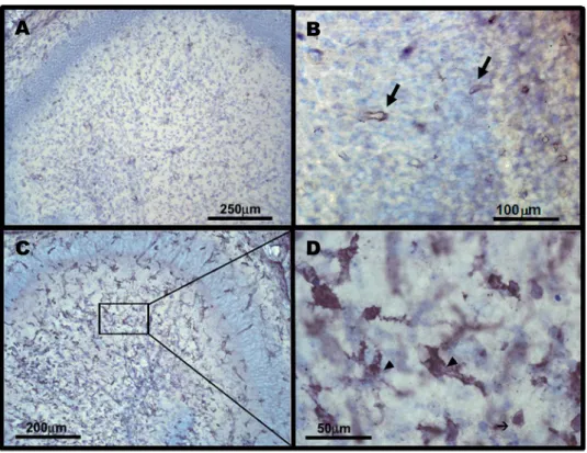 Figura 4: Micrografias de secções de cérebros de camundongos dos grupos  controle (A-B) e infectados com o vírus Curionopolis 5d.p.i