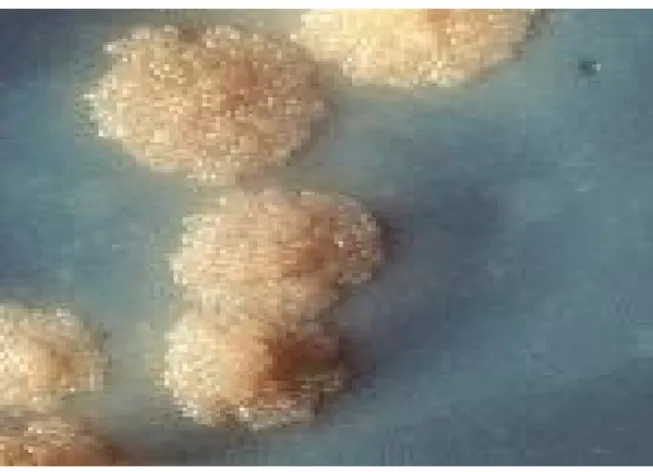 Figura 6 - Colônias de M. tuberculosis em meio de cultura de Lowenstein Jansen  (Fonte:http://wikipedia.org/wiki/Tuberculose) 