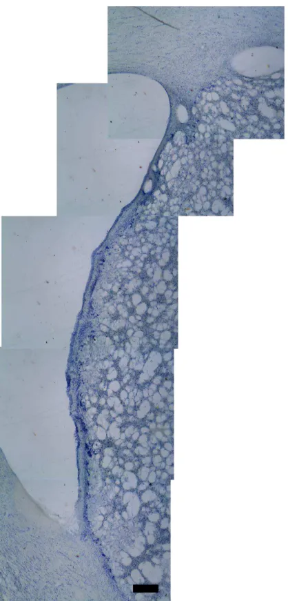 Figura 2. Comparação visual da presença de células entre a zona subventricular e o a  região próxima ao vértice inferior do ventrículo lateral