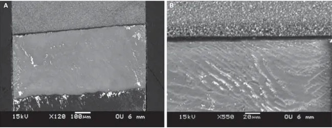 Figure 2. Interface of restoration using One Up Bond in enamel, presenting the lower sealing among the adhesive systems tested (A-X120) and (B-X 550).