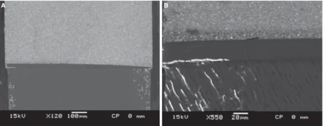 Figure 3. SEM ﬁ gures of the silver nitrate uptake in dentin of interface of the restoration performed with Clear ﬁ l Protect Bond showed few points of silver nitrate in ﬁ ltration (A-X120) and (B-X 550).