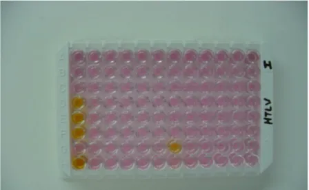 Figura  11:  Placa  para  realização  do  teste  ELISA:  amostras  positivas  apresentam coloração amarela