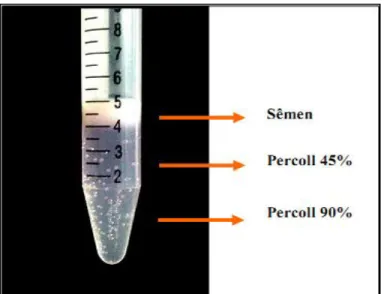 Figura  9: Fotografia mostrando  o  sêmen  sobre  gradiente  descontínuo  (45  e  90%,  respectivamente)  de  Percoll