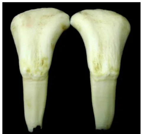Figura 1 - Dentes bovinos após limpeza. 
