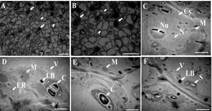 Figure  5  -  Photomicrographs  (A-B)  and  transmission  electron  micrographs  (C-F)  of  Passiflora  gibertii callus cells grown in a MS half strength salt concentrations medium with BA and  maintained  in  the  light
