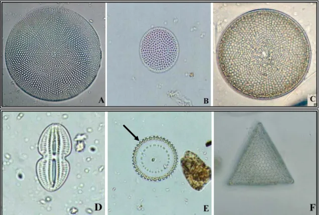Figura 18: Espécies mais abundantes de diatomáceas encontradas nos sedimentos de    manguezal: 