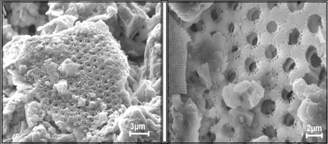 Figura 20 a: Fotomicrografias ao MEV de frústulas de diatomáceas relativamente preservadas                      encontradas nos sedimentos dos manguezais estudados.