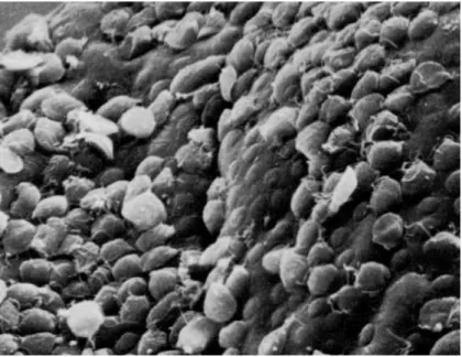Figura  6  -  Trofozoitos  de  Giardia  “atapetando”  o  epitélio  intestinal,  à  microscopia  eletrônica de varredura, com aumento final de 1500x