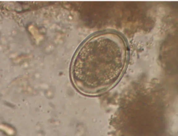 Figura 10 – Ovo embrionado de ancilostomídeo, à microscopia óptica, corado com  lugol e com aumento final de 400x 