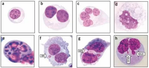 Fig. 7: Parâmetros de avaliação no ensaio de  formação de  micronúcleos. (a) células mononucleada, (b)  células binucleada, (c) célula multinucleada, célula em processo degenerativo por necrose (d) ou apoptose  (e), células apresentando micronúcleo (MN) (f