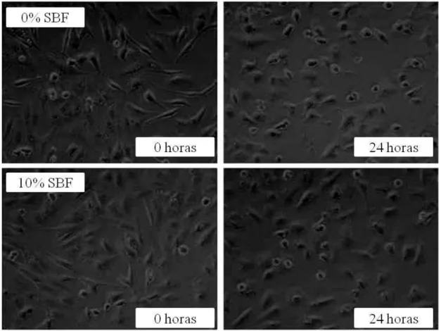 Fig. 11: Morfologia celular da linhagem C6 exposta ao metilmercúrio na concentração de 5 µM por um  período de 24 horas na ausência de soro bovino fetal (linha superior) ou suplementado na proporção de  10% (V/V; linha inferior)