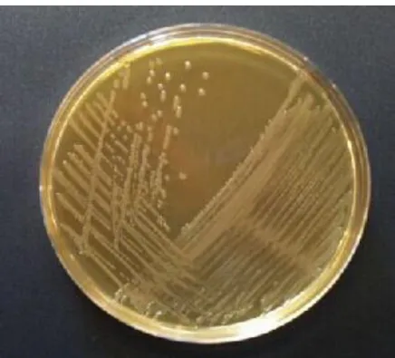 Figura 6 – Colônias de Salmonella Typhi em placa de Agar Salmonella Shigella.  