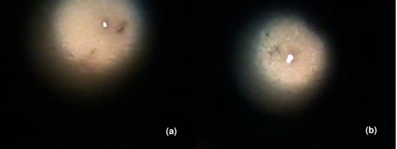 Figura  4:  Leitura  das  lâminas  em  microscópio  óptico  com  objetiva  40x  demonstrando  células  de  Candida albicans sem brotamento (a) e com brotamento (b) 