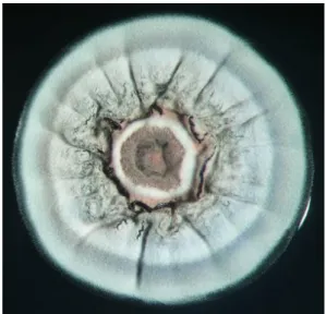 Figura  10:  Colônia  do  fungo  Streptomyces.  Fotografado  por  Ramón  Santamaría.  IMB/CSIS- IMB/CSIS-USAL