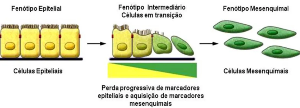 Figura 6 – Transição epitélio mesenquimal: Modificação do fenótipo epitelial para um fenótipo mesenquimal