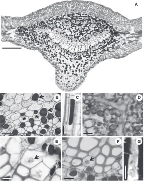 Figura 1 - Micrografias de luz das secções da lâmina foliar de Parahancornia fasciculata