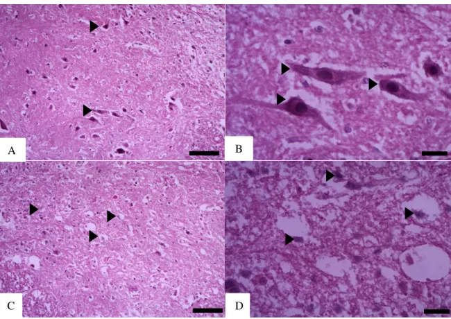 Figura  7  -  Lesão  medular  por  hemissecção  em  T8.  Medula  espinhal  corada  por  hematoxilina-  eosina  (HE)