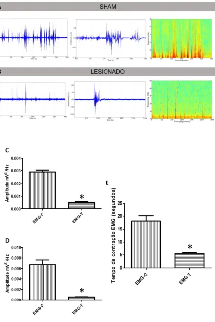 Figura  9.  Eletromiograma  (EMG):  Registro  dos  animais  do  grupo  Sham  com  contração  do  músculo semitendinoso durante o registro (A), registro do músculo semitendinoso dos animais  submetidos  à  lesão  medular  (B)  (n=4)