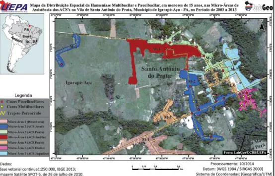 FIGURA 06- Distribuição espacial dos casos de hanseníase em menores de 15 anos, por classificação PB/MB e por área de ACS,  em área hiperendêmica da região Norte do Brasil, no período de 2003 a 2013