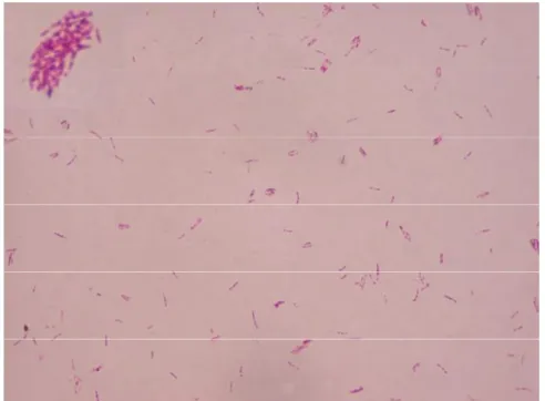 Figura  4: Mycobacterium  leprae isolado  de  pele  de  paciente multibacilar e corado pelo método de Ziehl-Neelsen, 1000x.