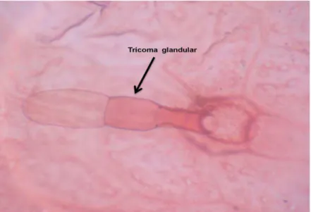 Figura  8: Epiderme abaxial da folha de M. lindleyana DC mostrando tricoma glandular 