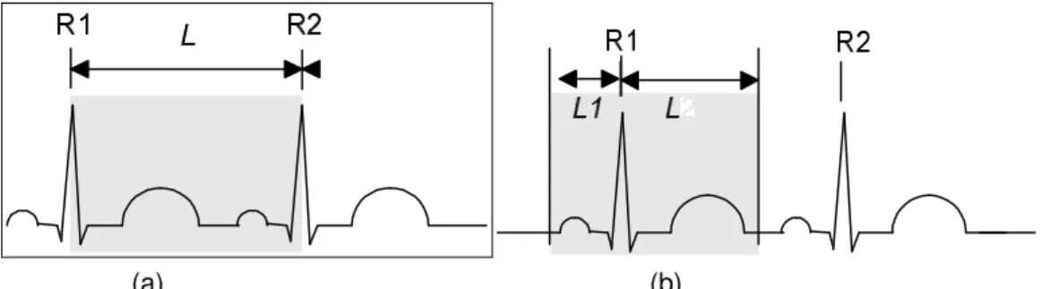 Figura  2.8  -  Segmentação  de  batimentos  por  2  métodos  diferentes.  L  é  a  distância  temporal  entre  duas ondas R consecutivas