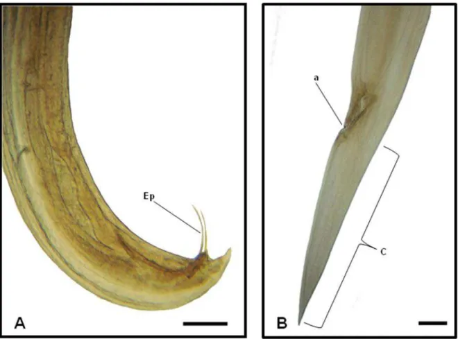 Figura 5: Fotos de Microscopia de luz de exemplar de Nematoda da Família Kathlaniidae, parasito  de  intestino  grosso  de  Philander  opossum