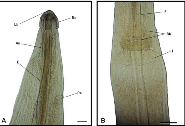 Figura  13:  Fotos  de  Microscopia  de  Luz  de  exemplar  fêmea  de  Nematoda  da  Família  Aspidoderidae, parasito de intestino grosso de Philander opossum