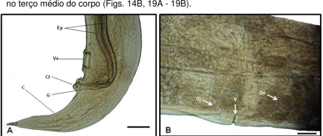 Figura 14: Fotos de Microscopia de Luz de exemplares  de Nematoda da família Aspidoderidae,  parasitos de intestino grosso de  Philander opossum