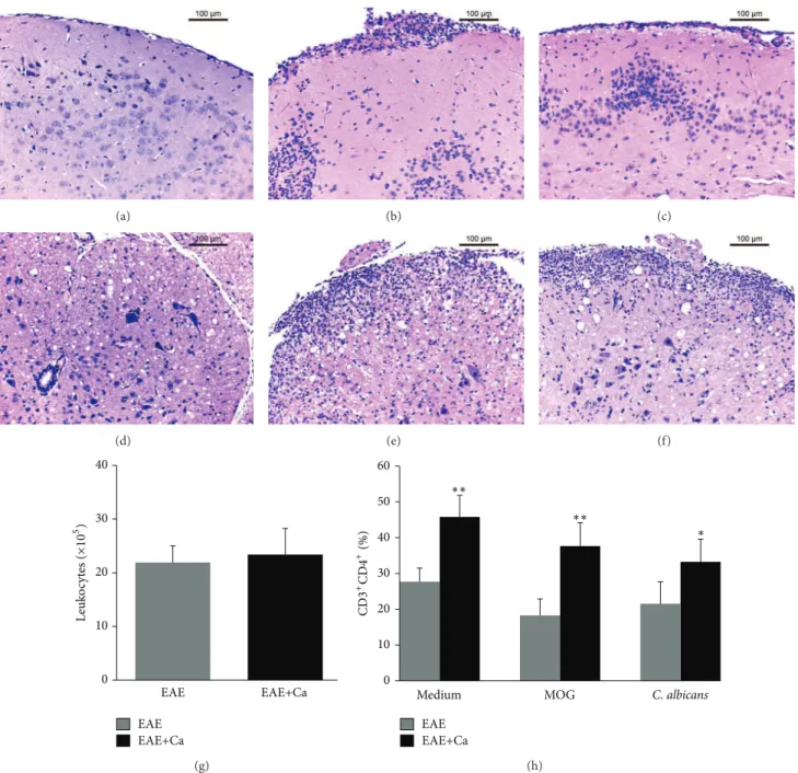 Figure 5: Previous infection with C. albicans increases the amount of CD4 + T cells in the CNS