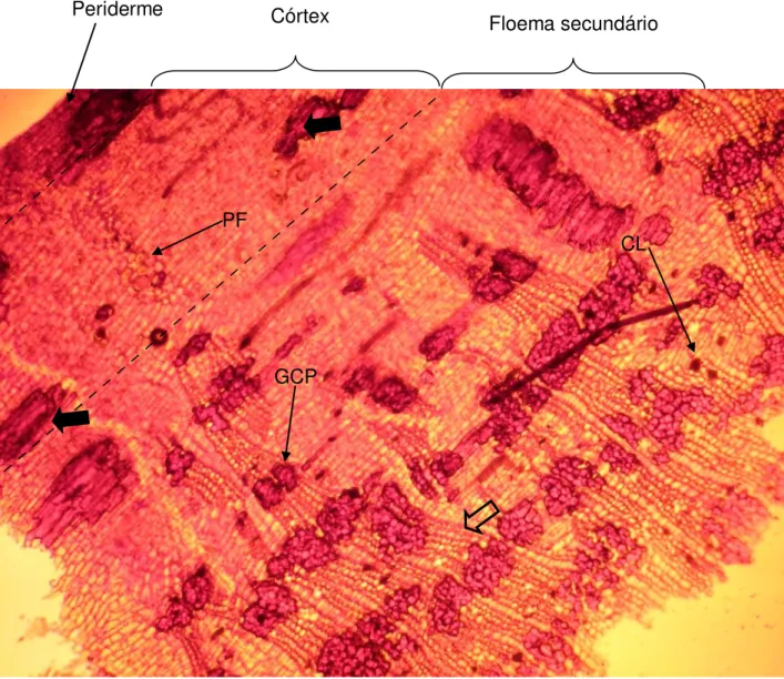 Figura 4 - Seção transversal da casca de Himatanthus lancifolius. Corada com safranina e observada  em  microscópio  com  aumento  de  10X