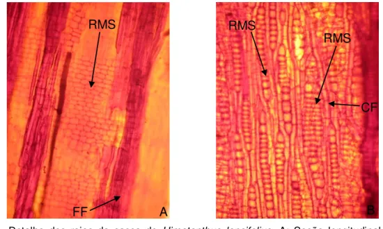 Figura  6  -  Detalhe  dos  raios  da  casca  de  Himatanthus  lancifolius.  A:  Seção  longitudinal  radial;  B: 