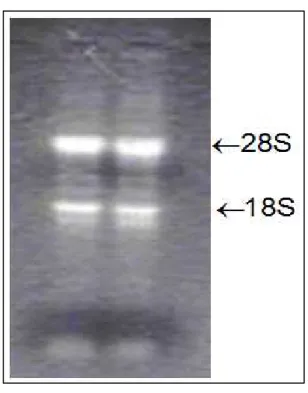 Figura 9 - Corrida eletroforética em gel  de  agarose  com  fomaldeído  para  RNA,  evidenciando  as 