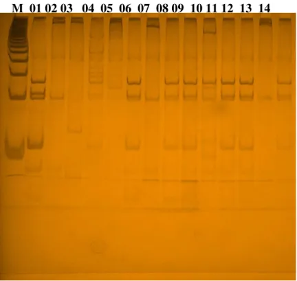 Foto  1-  Padrões  de  bandas  CS-PCR-RFLP.  A  digestão  dos  produtos  amplificados  de  variantes P