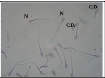 Figura  8.  Imagem  de  microscopia  óptica  de  espermatozóides  bubalinos,  corado  em  vermelho  congo  e  violeta  genciana,  em  aumento  de  100x