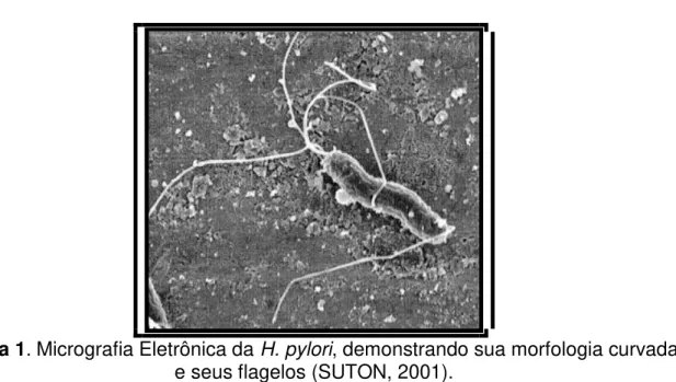 Figura 1. Micrografia Eletrônica da H. pylori, demonstrando sua morfologia curvada  e seus flagelos (SUTON, 2001)