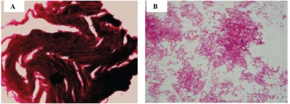 Figura 1. Aspecto do esfregaço de micobactérias corados pela técnica de Ziehl-Nelsen. A –  Complexo M