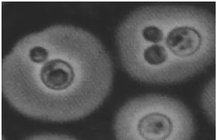 Figura 1.1  –  Microscopia óptica de C. neoformans , delineando  a  cápsula  polissacarídica  pela  “Tinta  da  China”